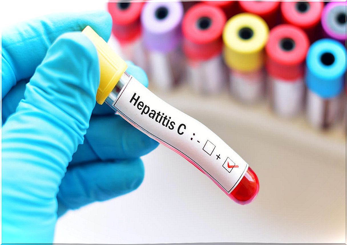 Hepatitis C in pregnancy