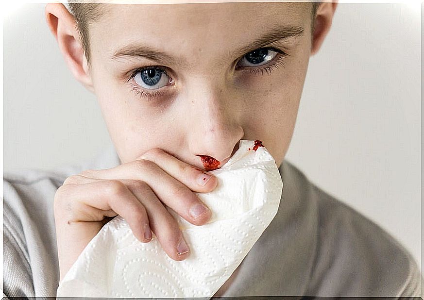 Why is my child getting blood from his nose?